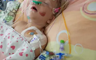 Zlepšit Ellince život