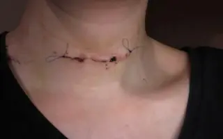 V patnácti prodělala rakovinu. Teď rozjíždí značku svíček KIMARO.