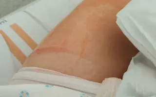 Pomoc pro pěti člennou rodinu: Otec bojuje s nálezem na ledvině