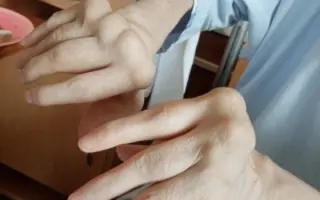 Pomozte Alče psát dál i v nejtěžší kapitole života