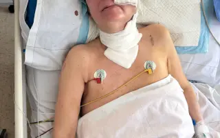 Po rakovině přišla o oko, pomozme jí zlepšit život