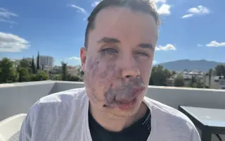 Pomozme Lukášovi zvládnout léčbu v zahraničí