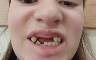 Pomozte mi vrátit úsměv po těžkém úrazu