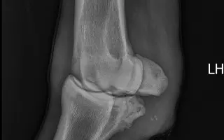 Valášek Artuš z Bezdědic - léčba a rehabilitace zlomeniny