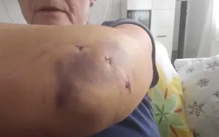 Pomoc pro kamarádku
