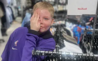 Šance pro Tondu na zotavení po vážných popáleninách