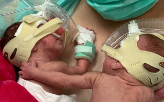 Pomozme Olince a Gábince, předčasně narozeným dvojčátkům
