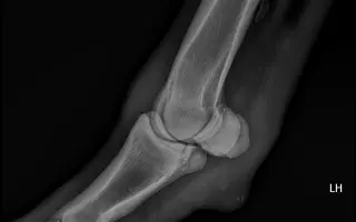 Valášek Artuš z Bezdědic - léčba a rehabilitace zlomeniny