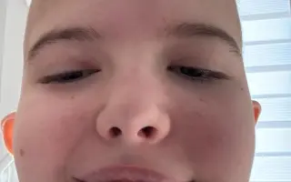 Pomozte Evitce v nejtěžším boji s rakovinou mozku