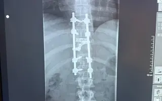 Šance pro Ondru znovu se postavit na nohy❤️