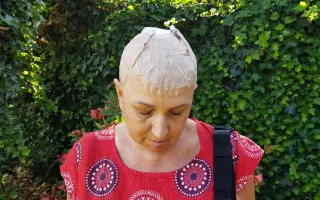 Pomozme Lence porazit nádor mozku
