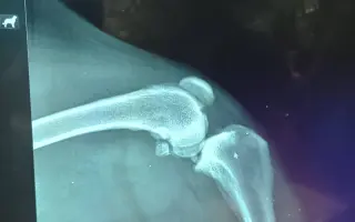 Operace kolene pro Meggie