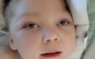 Neuroterapie pro Aleška