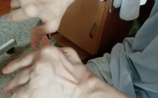 Alča váží jen 36 kg a bojuje o život! Pomozte.