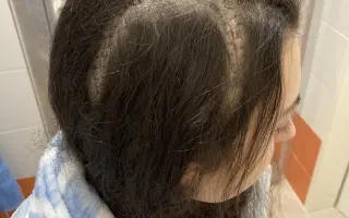 Pomozme Sáře v boji s rakovinou mozku