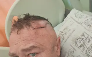 Sbírka pro mého manžela Dalibora s nádorem na mozku