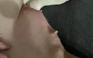 Pomoc pro Emilku – péče a vyšetření u veterináře