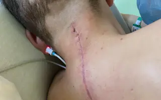 Skok, který změnil vše: Sbírka na léčbu kmenovými buňkami pro Pavla