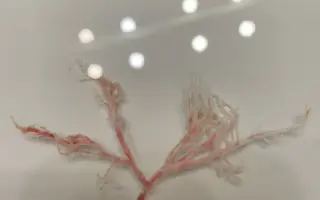 Dominickova cesta za zdravím: Bezpečné auto pro statečné srdce