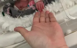 Pomoc pro Miušku v jejím každodenním boji - rehabilitace a pomůcky