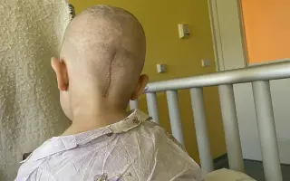 Oliverek (5) znovu bojuje s rakovinou
