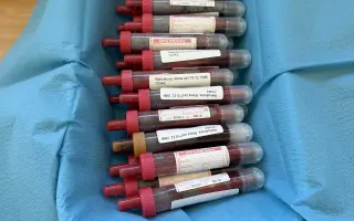 Lékařka Alča dál bojuje s glioblastomem - další šance na život