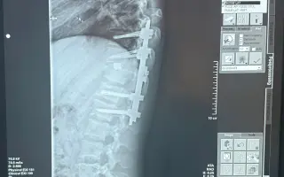 Šance pro Ondru znovu se postavit na nohy❤️