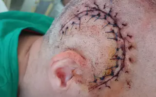 Nádor je zpět. Znovu musíme do boje o život manžela a táty našich dětí.