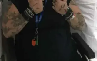 Pomozte Monice zvládnout nový život s hendikepem