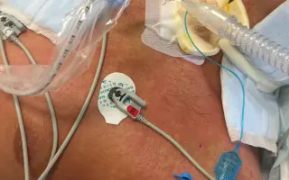 Pomozme Vasilovi uhradit léčbu