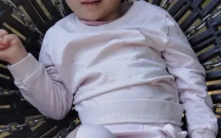 Pomozme malé Natálce se syndromem kočičího křiku