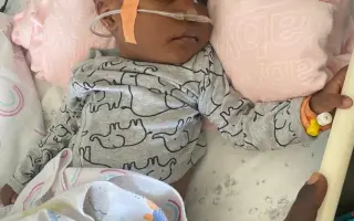 ❤️🙏 Pomoc pro malou Ayram z Ugandy s onemocněním plicní atrézie VSD