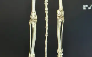 Ortopedické operace pro Quina a Rozvoda