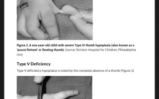 Překlad odborné příručky o Fanconiho anémii do češtiny