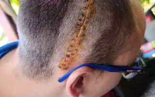 Pomozme našemu synovi v boji s nádorem mozku