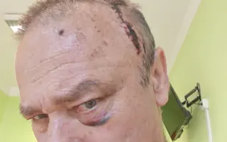 Sbírka pro mého manžela Dalibora s nádorem na mozku