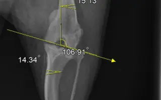 Šance na bezbolestný pohyb pro Pupika