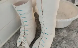 Každý krok se počítá - postavíme  Matyho na vlastní nohy