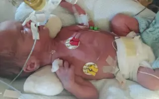 Šance na lepší život Tobiáška