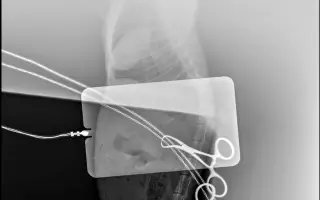 Nekonečný boj o záchranu zvířecích životů 😢