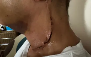 Po rakovině přišla o oko, pomozme jí zlepšit život