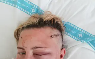Pomoc Lucii s tumorem mozku