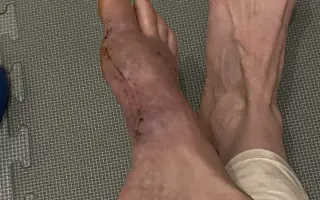 Naděje pro Karolinu (od Martina)