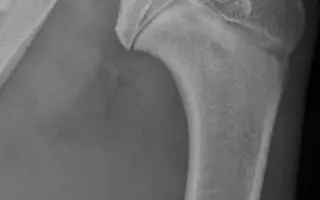 Podpora pro mladého farmářského psa po operaci OCD