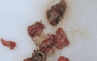 Kuki hledá pomoc pro svoji "paničku" - Bojujeme za každý den navíc