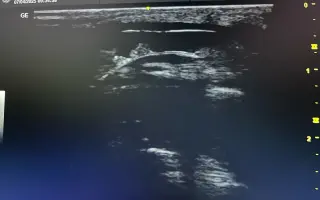 Pomozme Falcovi zachránit zrak a vrátit se k dětem, které ho milují