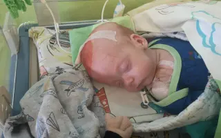 Epialarm a terapie pro malého Jarouška