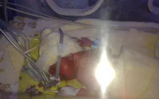 Pomoc pro Nikyho a Stellu – krok k lepším dnům