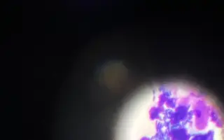 Pomoc Furině v boji s lupusem (SLE)