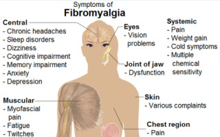 Výzkum fibromyalgie